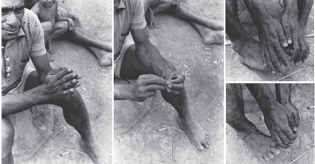 Iqwaye man counts on his fingers and toes